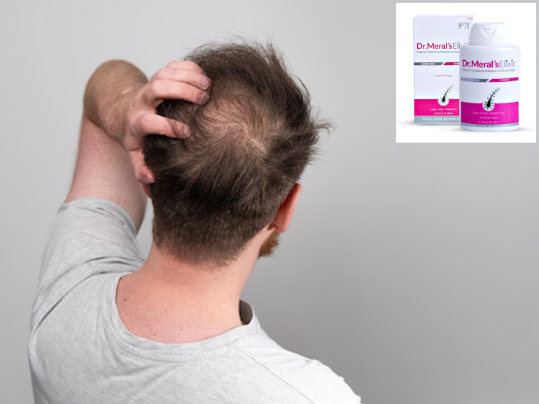 Dr. Meral's Elixir: работает ли средство против выпадения волос